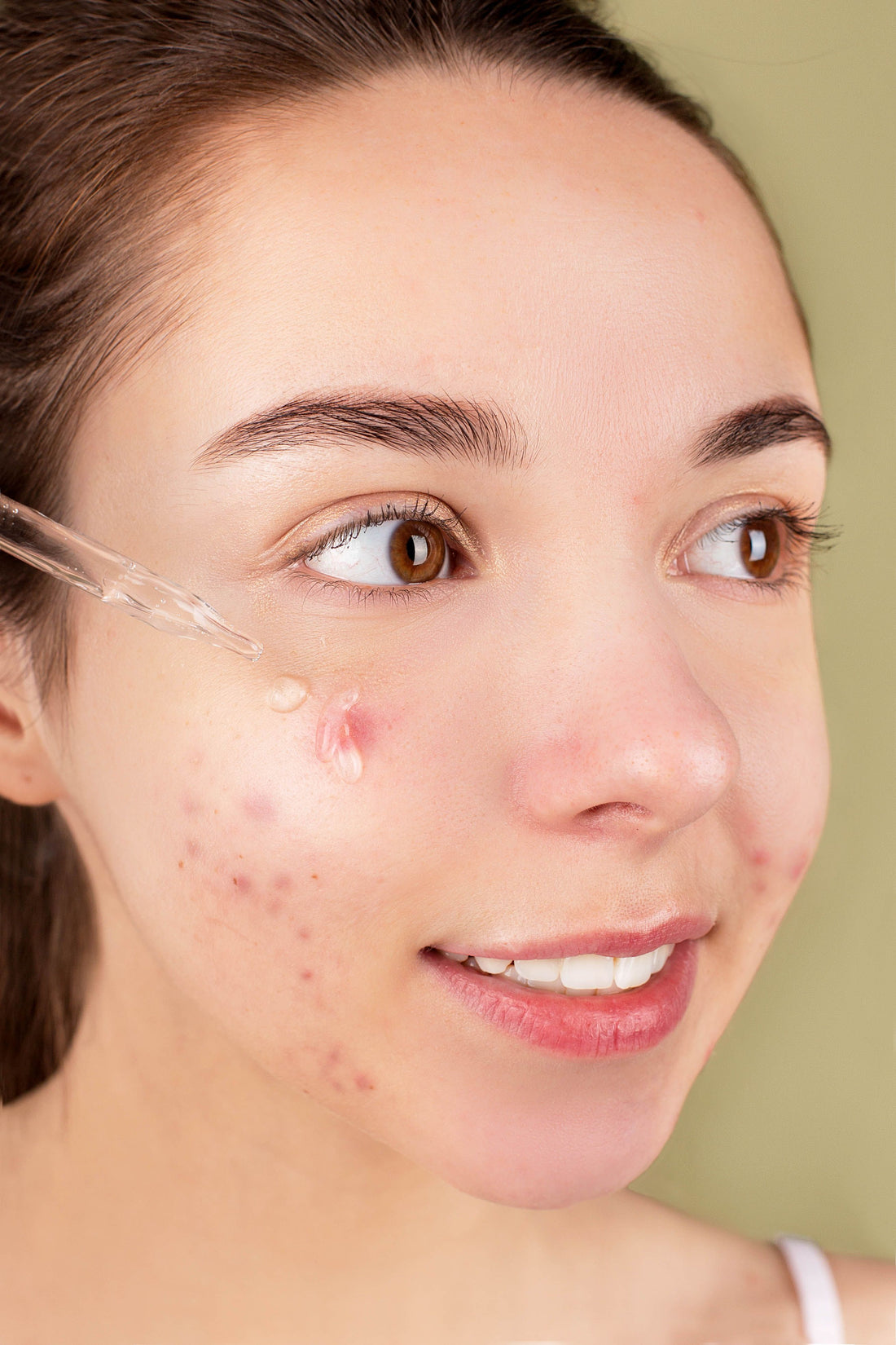 Mujer aplicando sérum de niacinamida — rutina skincare coreana para manchas